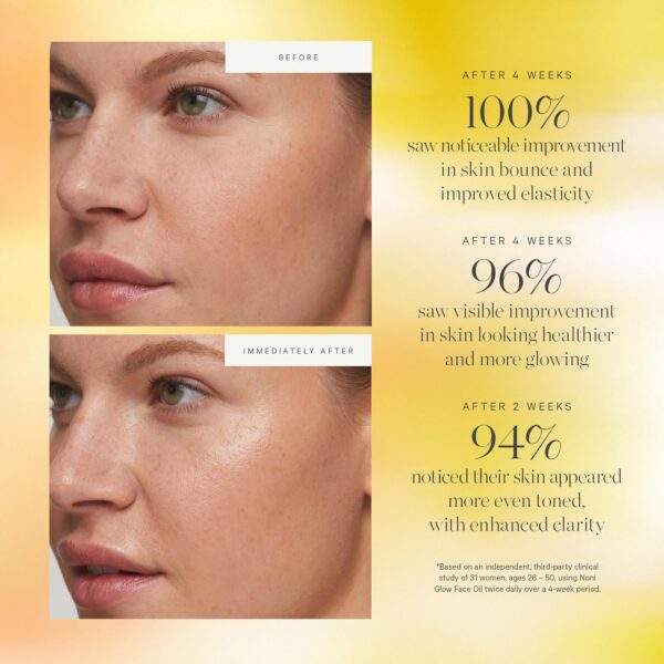 KORA Organics Noni Glow Hydrating Face Oil with Rosehip, Gua Sha Oil, Certified Organic, Cruelty…